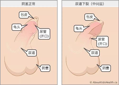 健康报 男性无法站着排尿？1.jpg