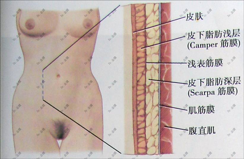 金骥  剖腹产瘢痕 图片4.jpg