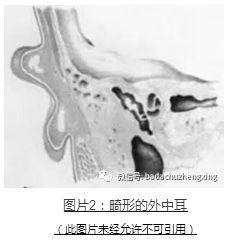 微信 小耳福音：我院开展耳廓整形+听力重建一站式手术治疗2.jpg